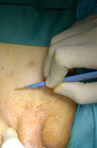 pelvic-surgery2018-1