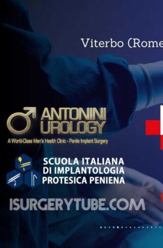 worlwide-streaming-2024-12-11-19-03-36