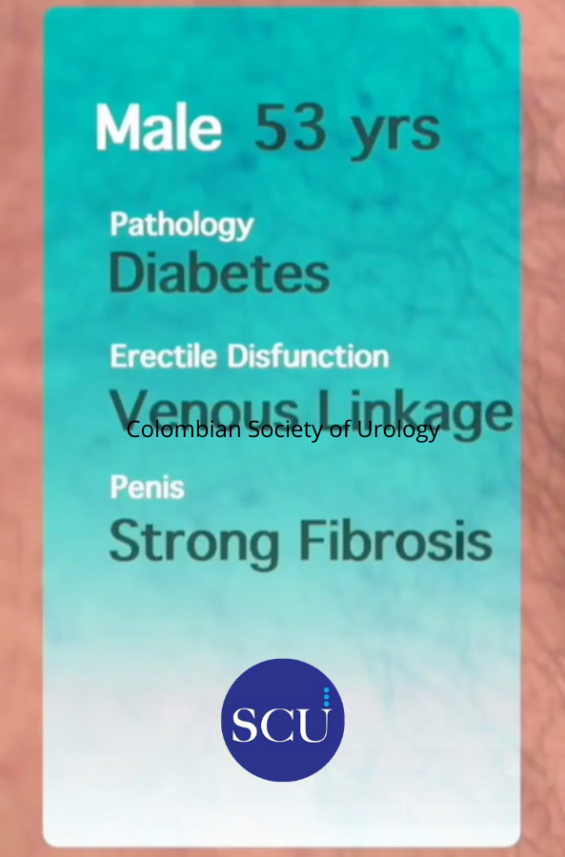 Colombian Society of Urology